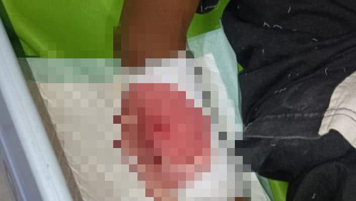 Fakta Insiden Berdarah Bocah SD Dibacok Teman Saat Main Bola Di Blitar