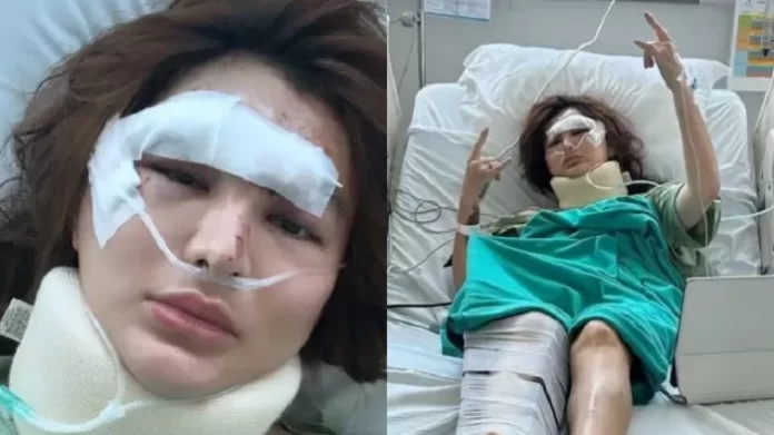 Angela Lee Dirawat Di Rumah Sakit Usai Mengalami Kecelakaan Mobil