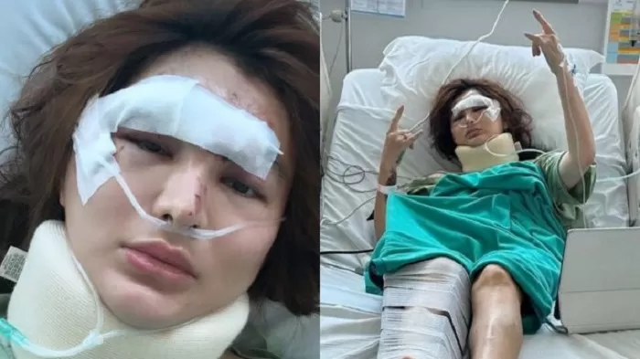 Angela Lee Dirawat Di Rumah Sakit Usai Mengalami Kecelakaan Mobil