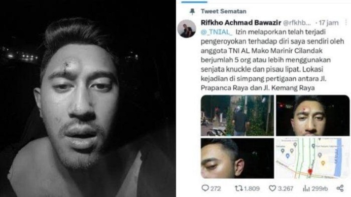 Seorang Pria Korban Pengeroyokan Beberapa Anggota Marinir Di Kemang