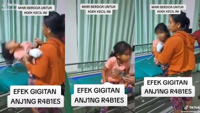 Seorang Balita Mengalami Kejang Saat Minum Akibat Terkena Rabies