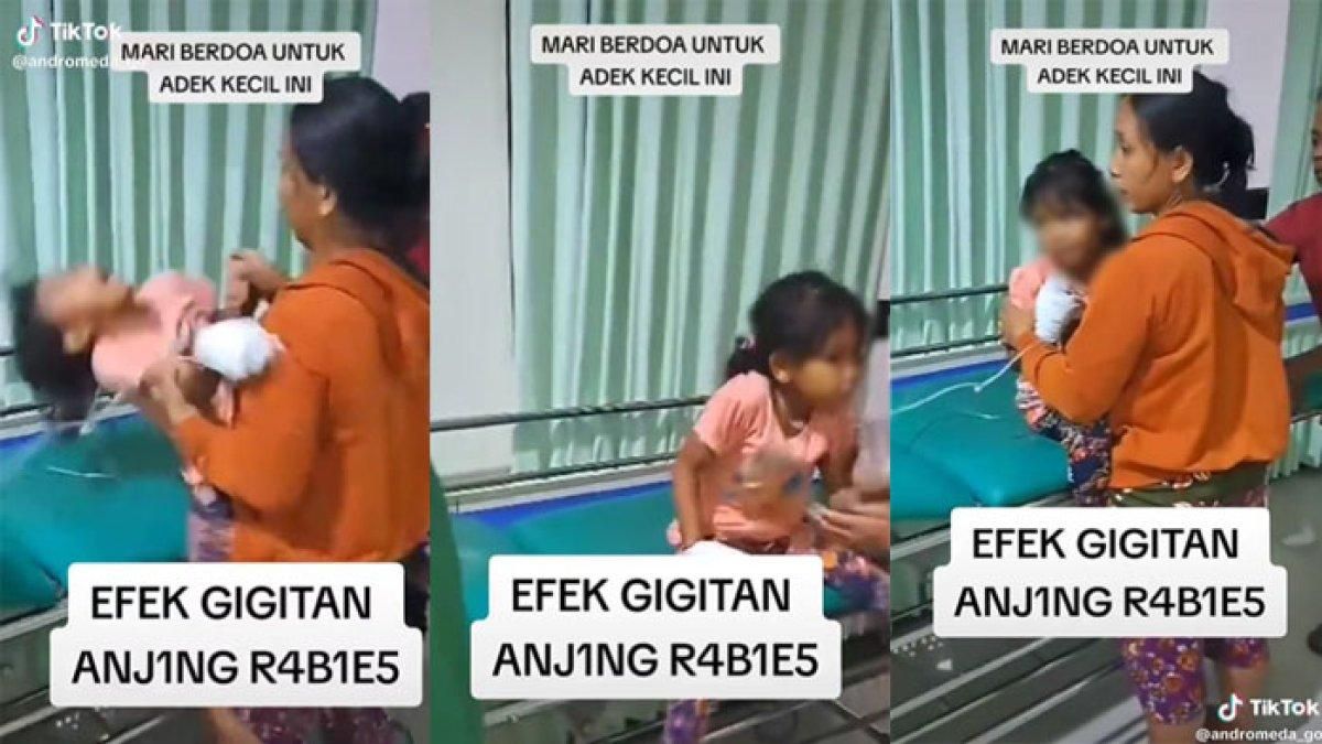 Heboh Seorang Balita Mengalami Kejang Saat Minum Akibat Terkena Rabies Di Bali