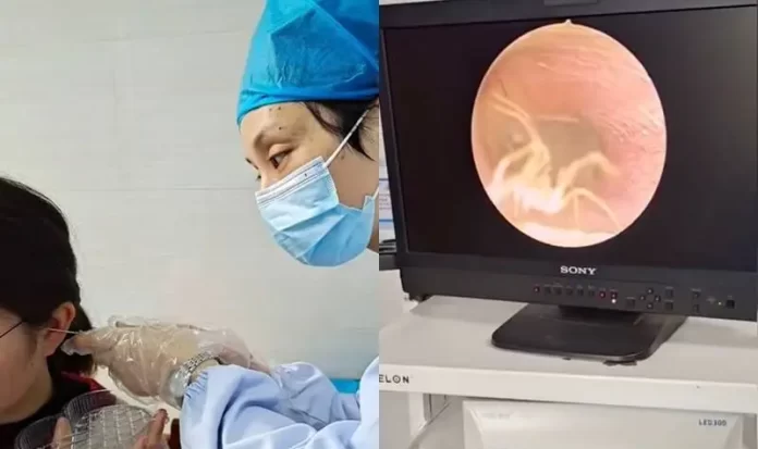 Seorang Dokter Menemukan Hal Mengerikan Setelah Memeriksa Telinga Seorang Wanita Tionghoa